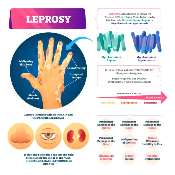 Leprosy Prevalence and Disability